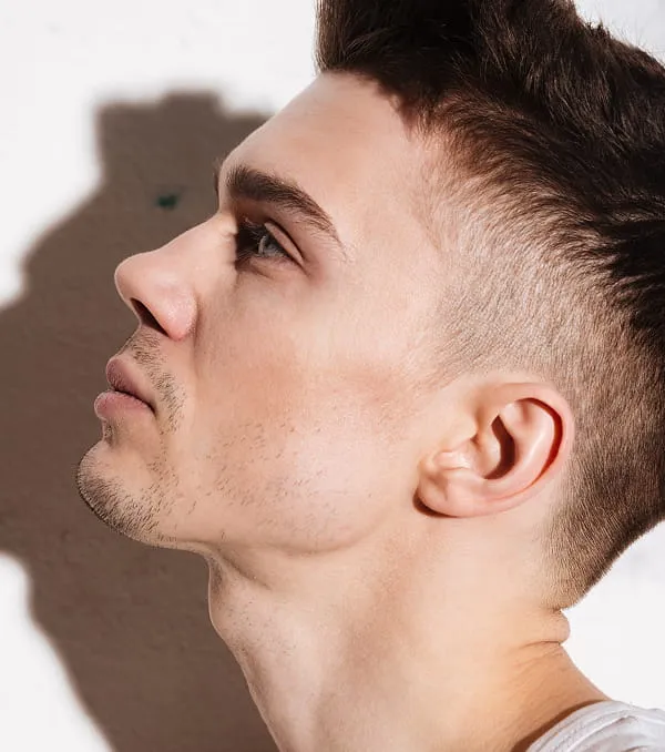 22_cirugia-facial-otoplastia-2